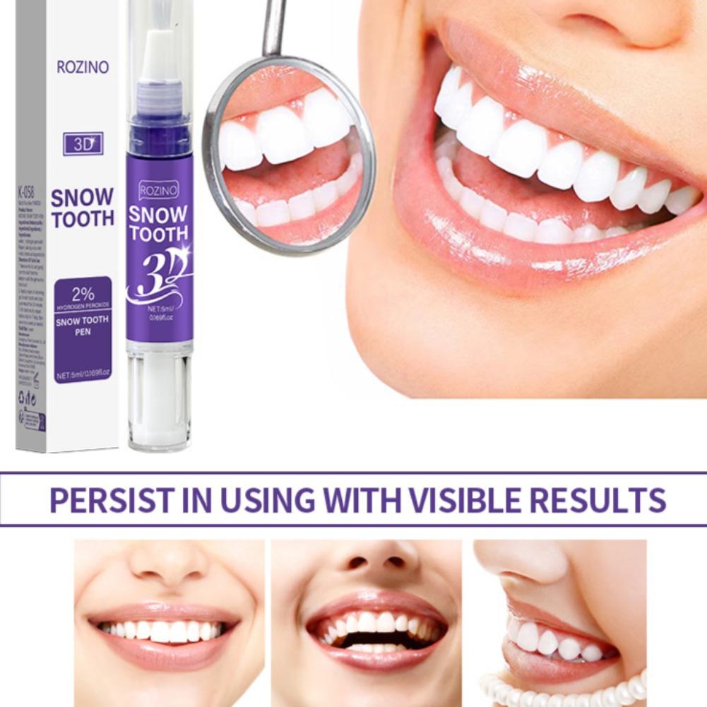 Unisex Oral Dental Care Pen An - огляд і ціна Teeth Whitening Pens